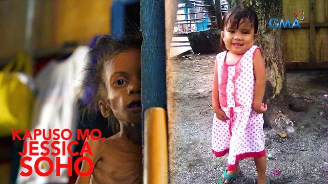 Kapuso Mo, Jessica Soho: BATANG MALUSOG NOON, PAANONG NAGING BUTO'T BALAT NA NGAYON?