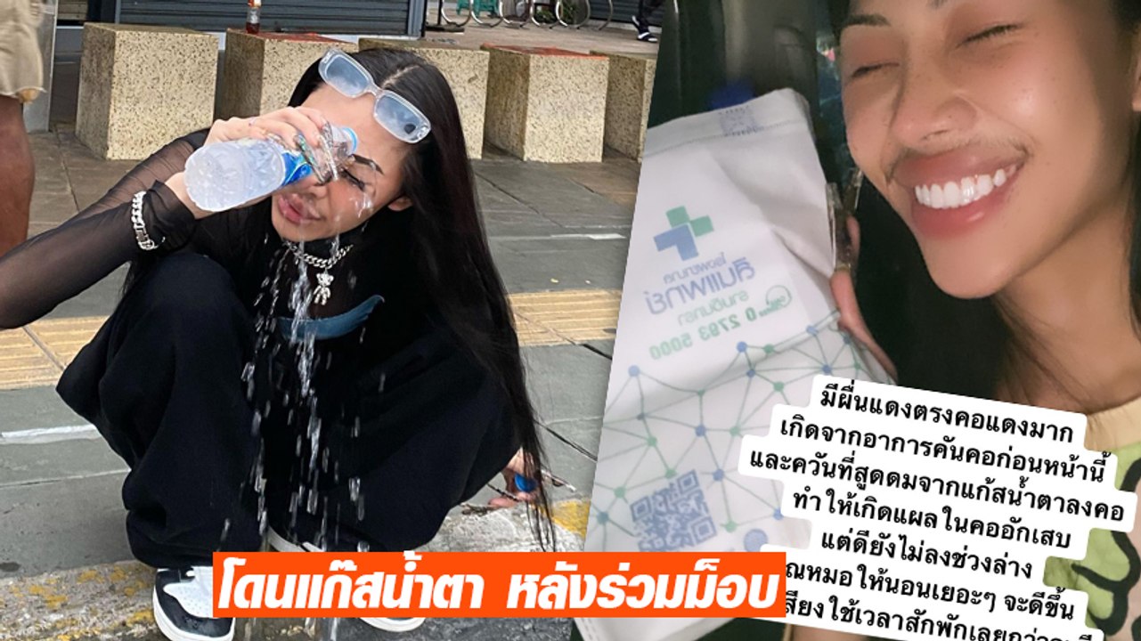 ฟลุ๊ค กะล่อน โดนแก๊สน้ำตา หลังร่วมม็อบ 7 สิงหา เผยแสบตามาก ลั่นทุเรศมากตำรวจไทย