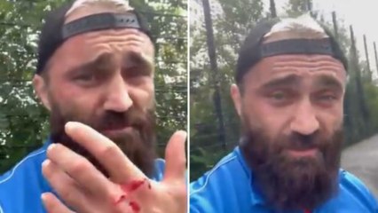 Avrupa Şampiyonu boksör Ünsal Arık saldırıya uğradı: Utanın, gerçekten üzülüyorum artık