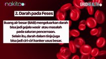 6 Gejala Kanker Usus Besar yang Jarang Disadari