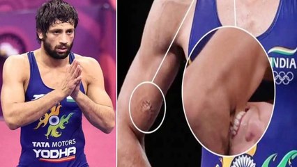 Ravi Dahiya : హగ్ చేసుకొని సారీ చెప్పిండు.. దారుణంగా కొరికినా క్షమించేసాడు గా ! || Oneindia Telugu