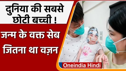 World Smallest Baby 13 महीने बाद Hospital से लौटी घर, जन्म के समय 212 gm था वज़न | वनइंडिया हिंदी