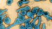 Premier cas du virulent et dangereux virus de Marburg en Guinée, assez proche du virus Ebola