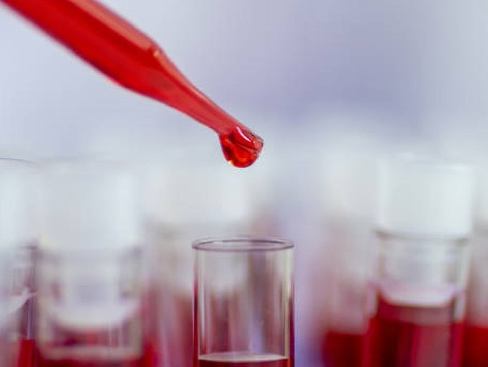 Vorsicht, Blutverlust: Ab wann er gefährlich wird