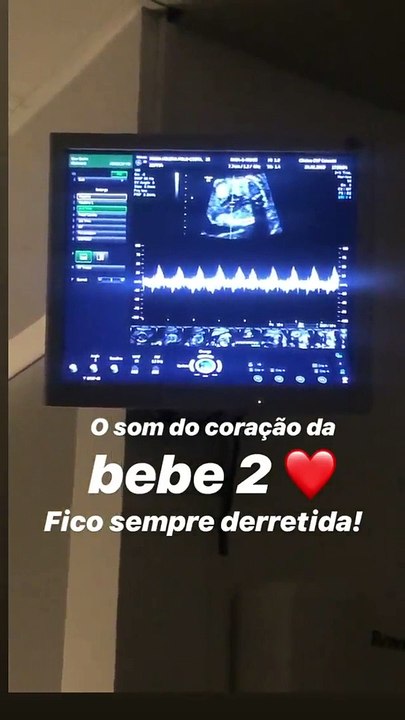 Helena Costa mostra o som do coração das filhas gémeas