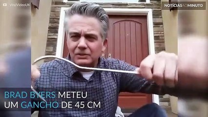 Homem balança uma âncora com gancho preso da cabeça!