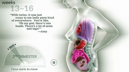 Museum of Science and Industry, Chicago