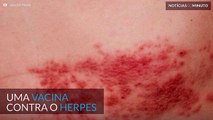 Testada com sucesso nova vacina para herpes
