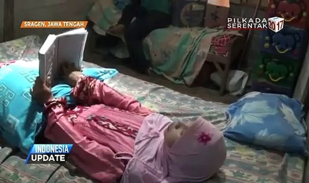 Mulher sofre de doença que a deixou rija como uma pedra