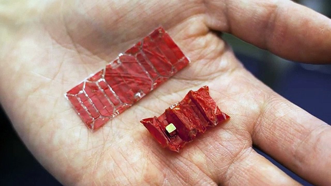 Robot pode operar corpo humano a partir do interior