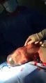 Um caso raro: este bebé nasceu sem romper a bolsa amniótica