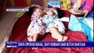 Bayi Kembar Siam Belum Operasi Pemisahan Akibat Biaya yang Mahal