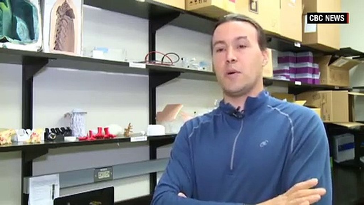 Galo volta a andar graças a próteses impressas em 3D