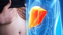 Liver Cirrhosis के इन शुरूआती Symptoms को ना करें नजरअंदाज | Boldsky