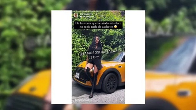 Marcela Reyes mostró cómo era su cola sin prótesis y tras retiro de biopolímeros