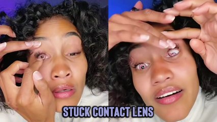 'Scary Moment Girl's Contact Lenses Get Lost in her Eyes *44 Million+ Views*'