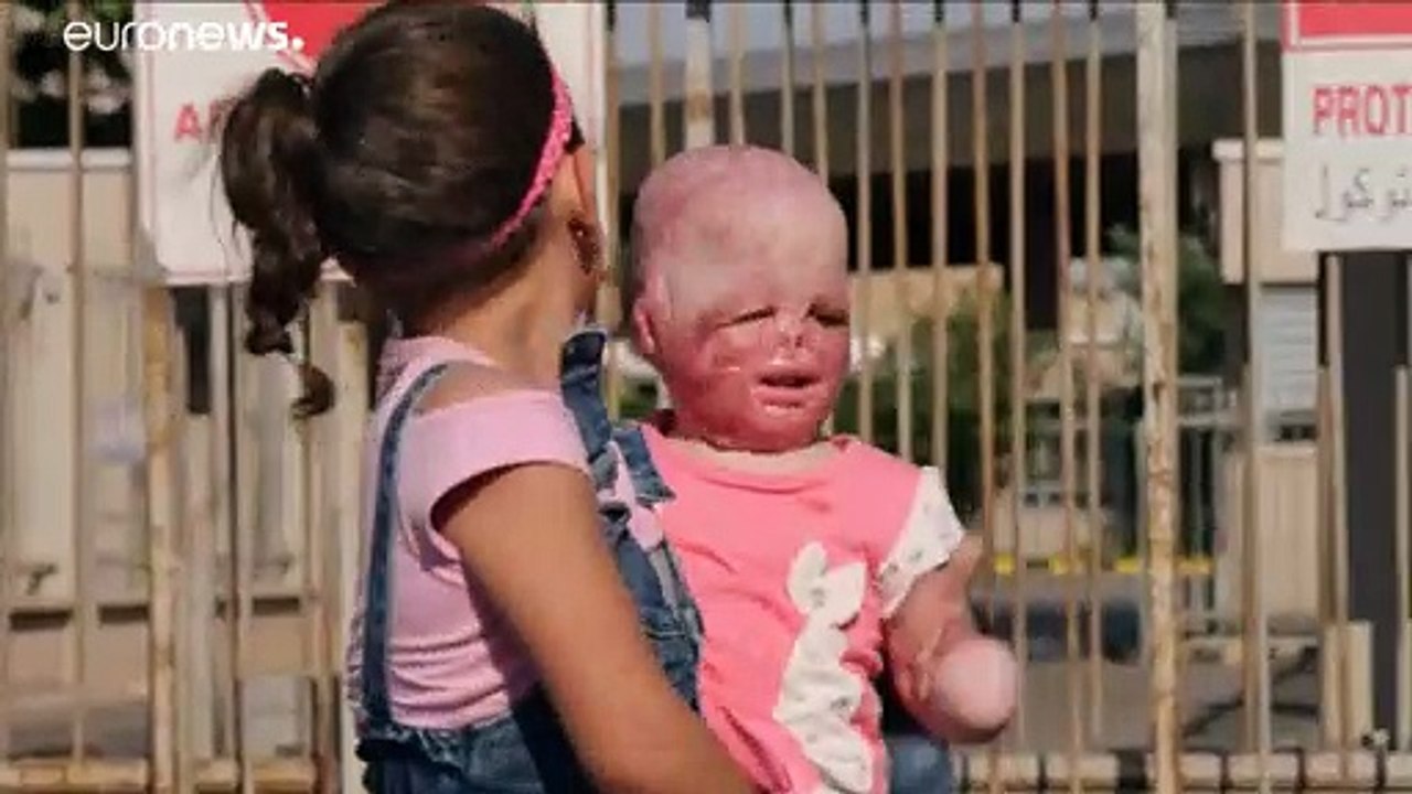 Syrisches 'Wunderbaby' wieder mit seiner Familie vereint