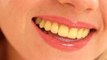 दांतों का रंग बताता है कि कितने बीमार है आप,जानें किस रंग के दांत होते हैं सबसे ज्यादा हेल्दी