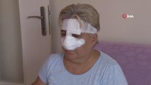 Antalya'da çocuk parkında pitbull dehşeti: 55 yaşındaki kadının burnu koptu