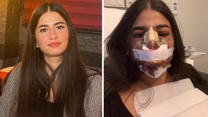 Burun estetiği yaptıran kadının hayatı karardı, pişkin doktor ise "Düğün hediyem olsun" dedi