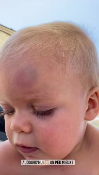 Hillary (Mamans & Célèbres) révèle que son fils Milo s'est blessé en vacances à Mykonos.