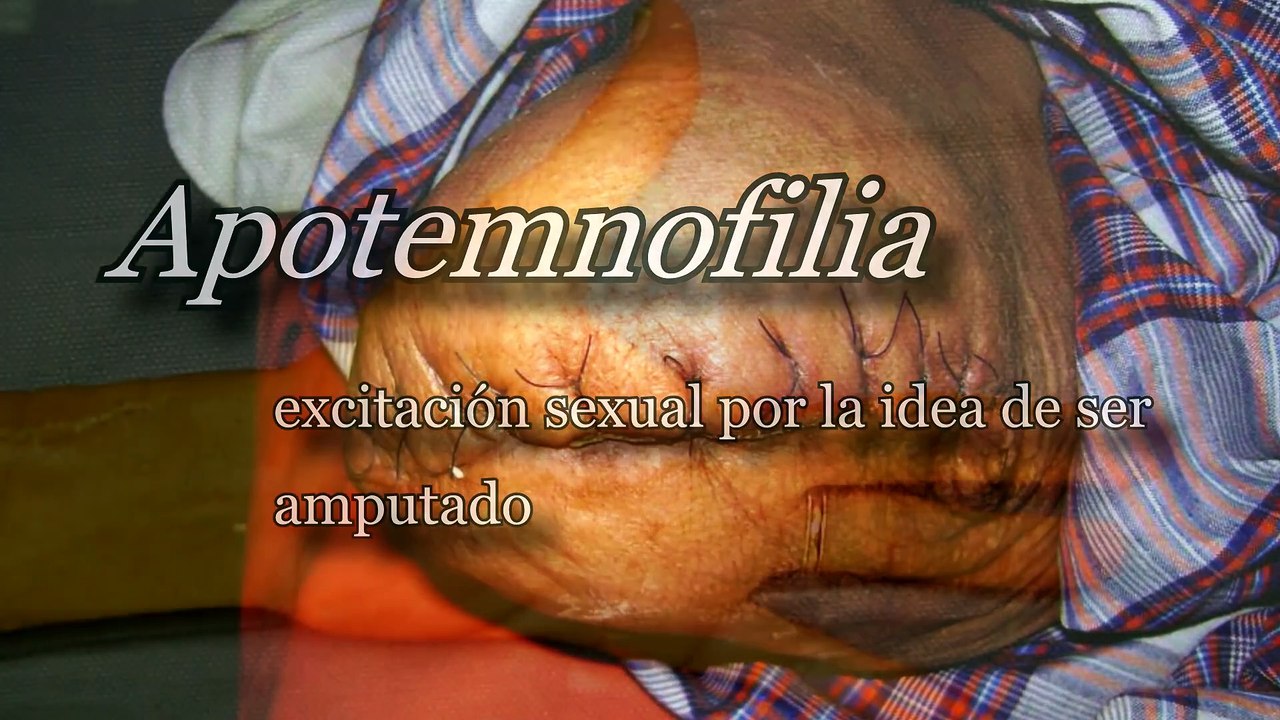 TOP_ las 7 parafilias más desconocidas {y terribles}