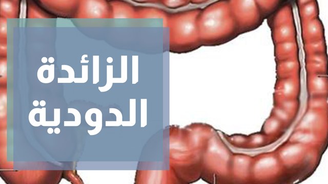 التهاب الزائدة الدودية