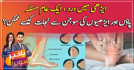 How to get rid of swelling of feet and heels?