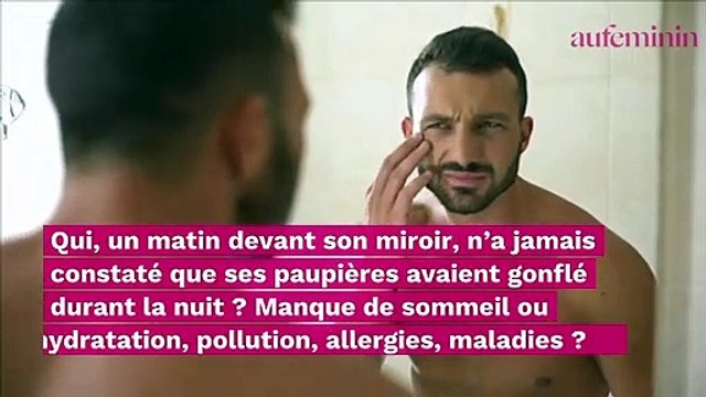 Paupières gonflées : quelles sont les causes et comment s’en débarrasser ?