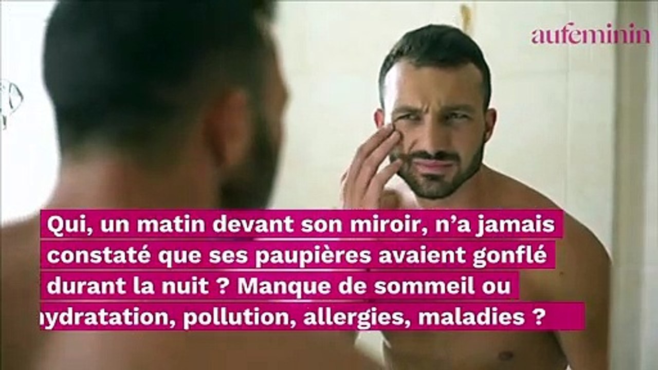 Paupières gonflées : quelles sont les causes et comment s’en débarrasser ?