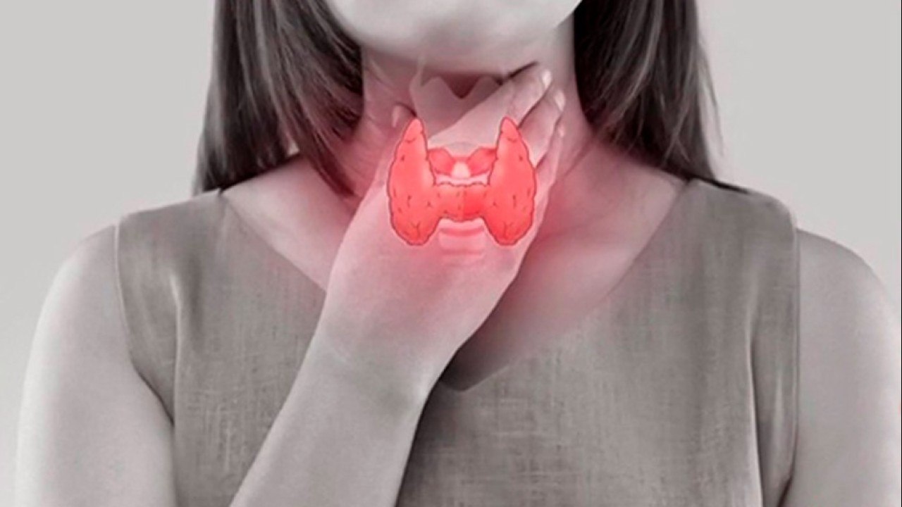 bd-tipos-de-tiroiditis-y-opciones-de-tratamiento-170821