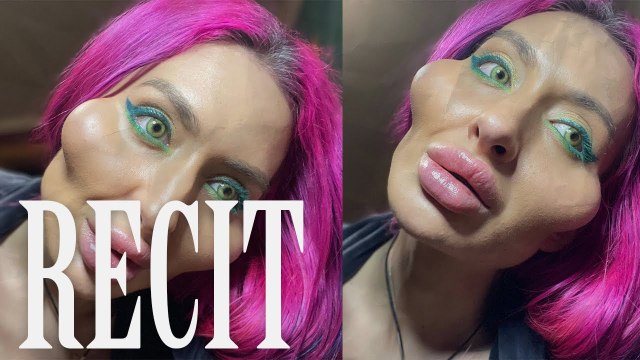 CE MANNEQUIN UKRAINIENNE A LES PLUS GROSSES JOUES DU MONDE !