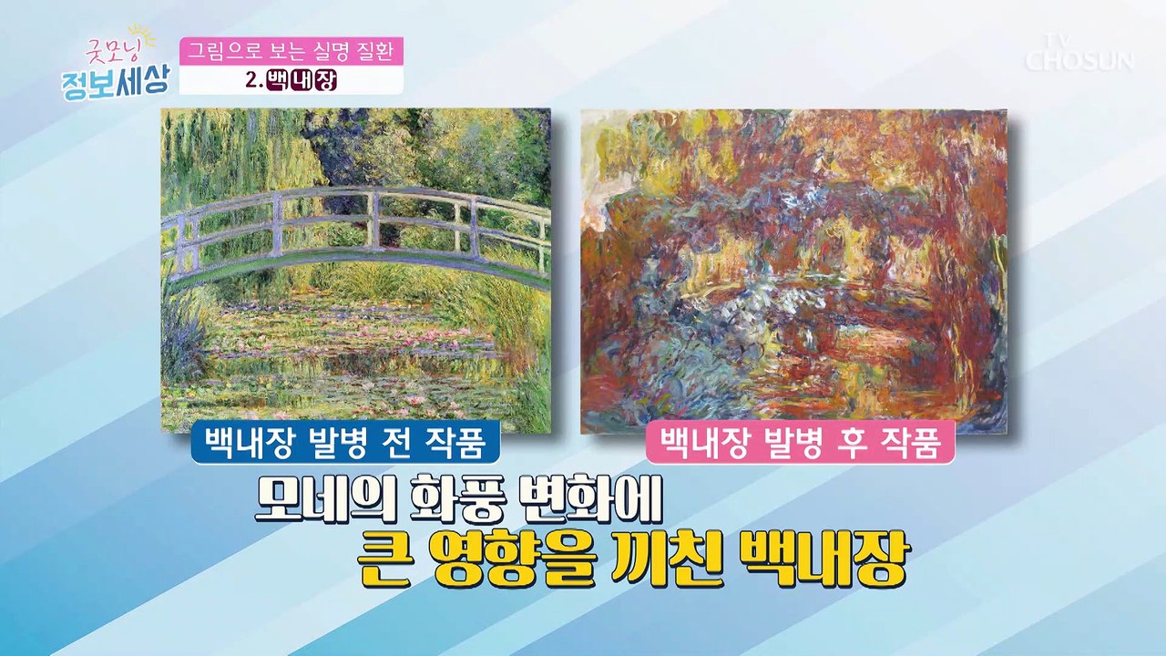방심은 금물! 실명까지 부르는 ‘3대 눈 질환’ ✓ TV CHOSUN 210818 방송
