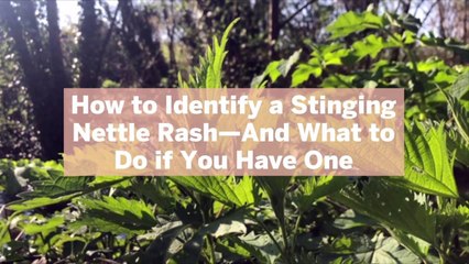 How to Identify a Stinging Nettle Rash—And What to Do if You Have One