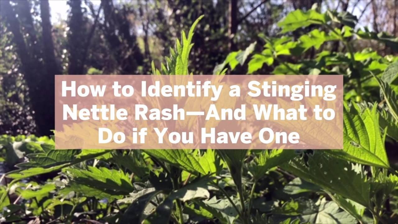 How to Identify a Stinging Nettle Rash—And What to Do if You Have One