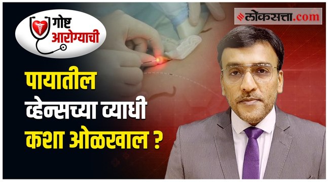 जाणून घ्या । पायातील सूज आणि व्हेन्सच्या व्याधींबद्दल