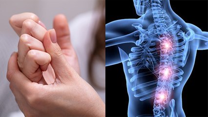 Bones से चटकने की आवाज़ हो सकता है किसी गंभीर बीमारी का इशारा, जानें इसकी वजहें और बचाव । Boldsky