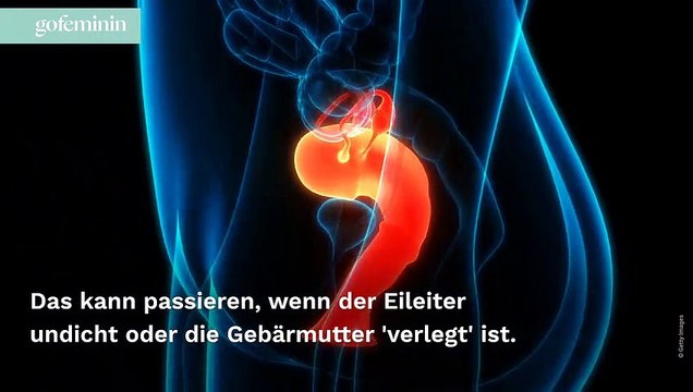 Bauchhöhlenschwangerschaft: Was ihr dazu wissen solltet