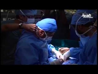 عملية فصل السيامي السعودي عبدالله وسليمان