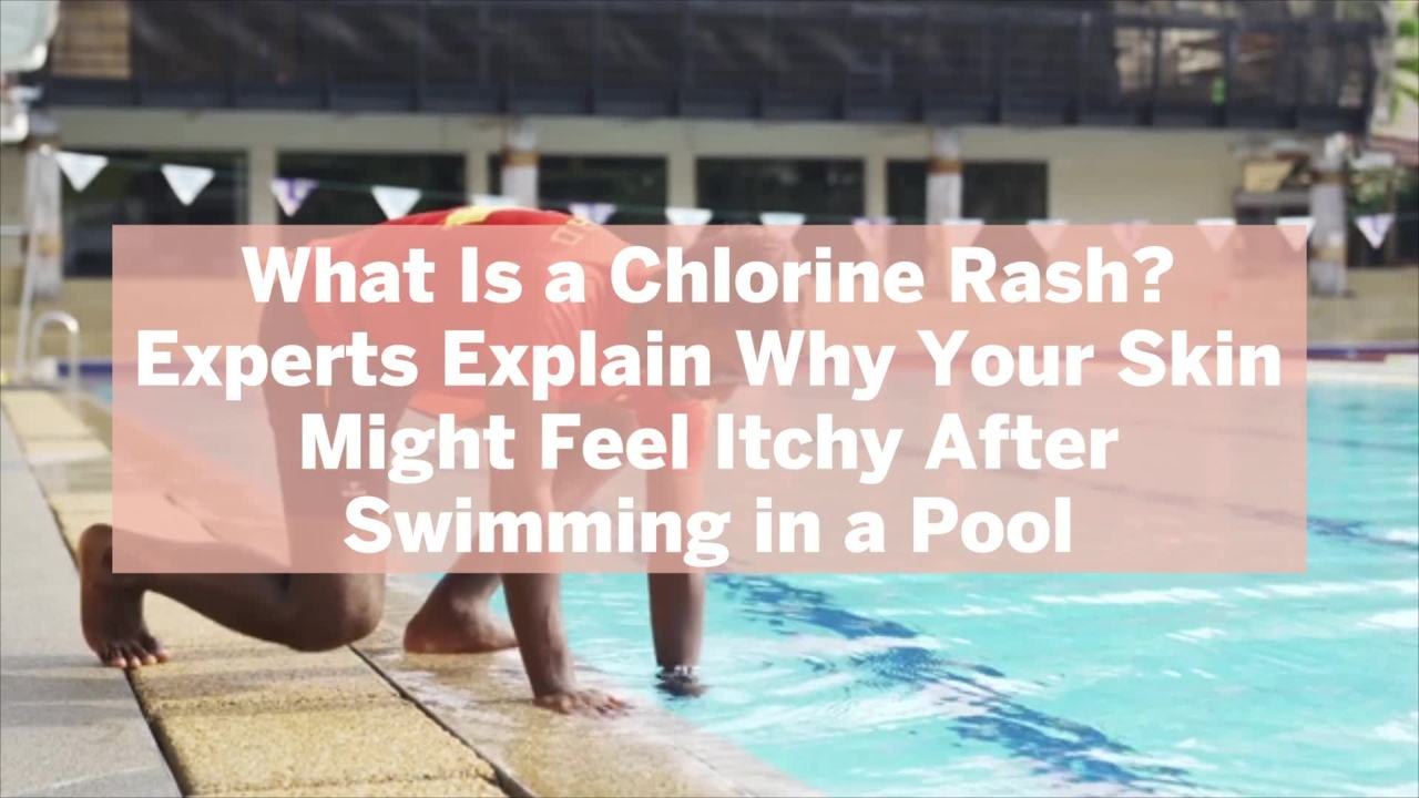 What Is a Chlorine Rash? Experts Explain Why Your Skin Might Feel Itchy