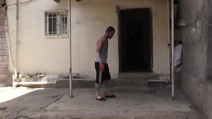 17 yıldır sedef hastalığıyla mücadele eden genç tedavi olmak istiyor