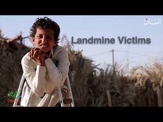 ألغام الحوثي تزرع الموت في اليمن