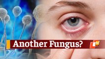 AIIMS Bhubaneswar Researchers Discover New Fungus Causing Mucormycosis