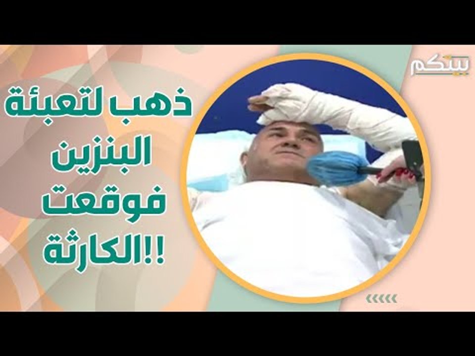 في كتير ما توا! أحد ضحا يا انفجا ر صهريج عكار يروي ما حصل معه!