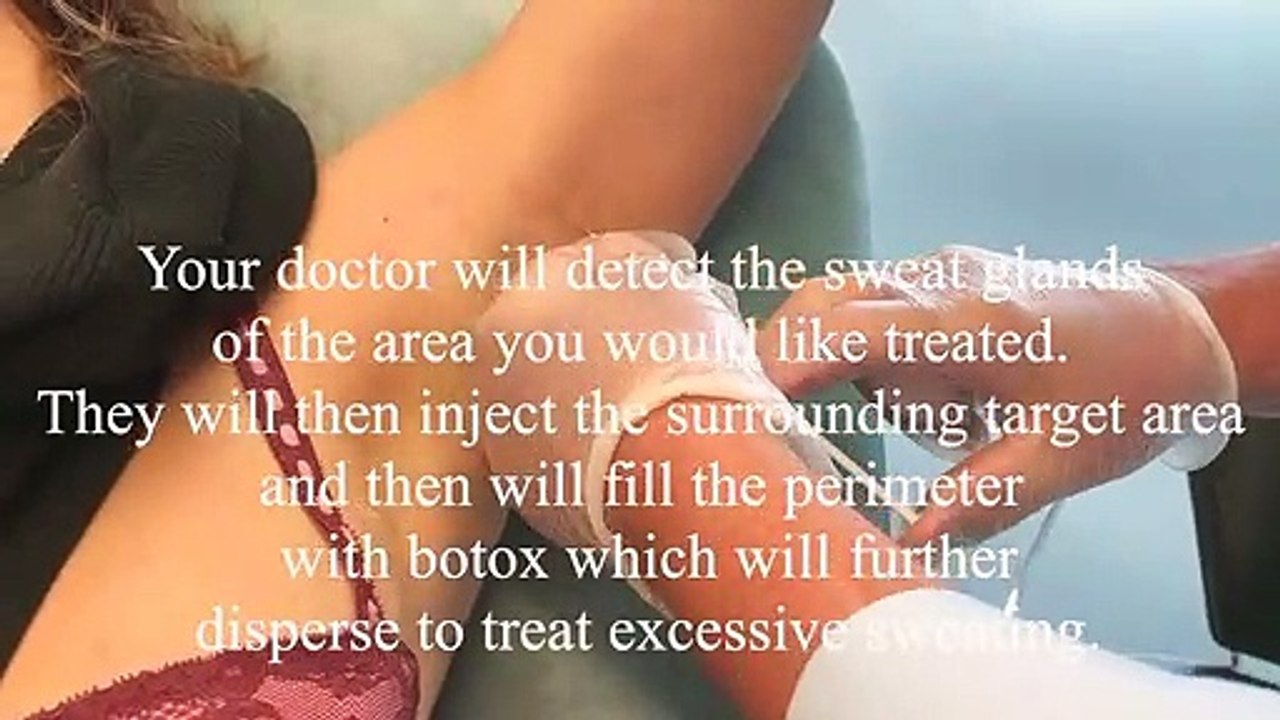 Bodyvie Medi-Clinic_ Botox for Excessive Sweating (Hyperhydrosis)