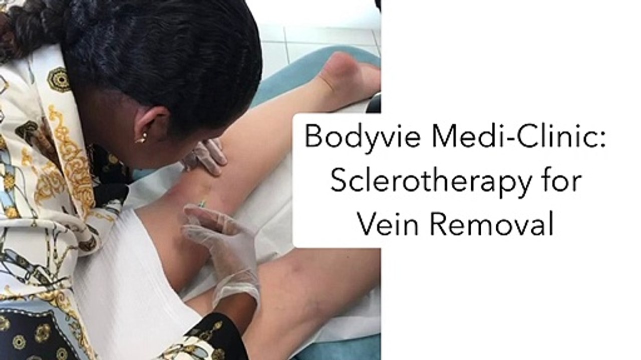Microsclerotherapy for Vein Removal - Bodyvie