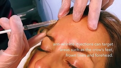 Bodyvie Medi-Clinic_ Anti-Wrinkle Injections