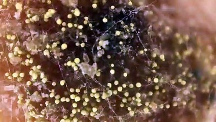 Moldy bread under the microscope