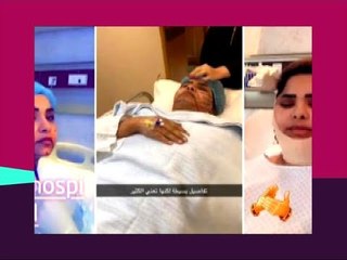 شاهدوا شكل هيا الشعيبي بعد خضوعها لعملية شد اللغلوغ