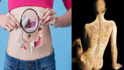 Body में Calcium की कमी से Cancer का खतरा, Doctors Advice | Boldsky